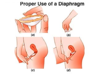 การสืบพันธ์