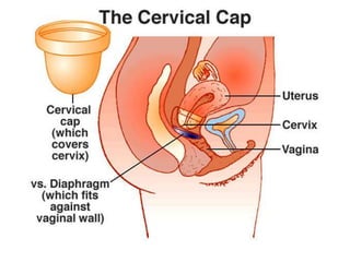 การสืบพันธ์