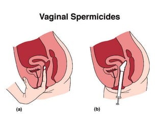 การสืบพันธ์