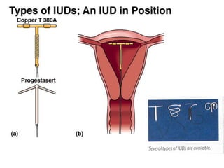 การสืบพันธ์