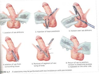 การสืบพันธ์