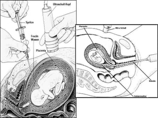 การสืบพันธ์