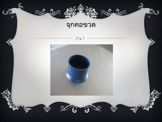 จุกคอྺวด
 