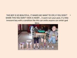 THIS BOY IS SO BEAUTIFUL, IT MAKES ME WANT TO CRY, IF YOU DON’T •
SHARE THIS YOU DON’T HAVE A HEART… it wont ruin your post, if a little
 innocent boy with a condition like this can smile anyone can smile! god
                                  bless
 