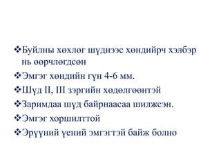 Буйлны хөхлөг шүднээс хөндийрч хэлбэр
 нь өөрчлөгдсөн
Эмгэг хөндийн гүн 4-6 мм.
Шүд II, III зэргийн хөдөлгөөнтэй
Заримдаа шүд байрнаасаа шилжсэн.
Эмгэг хоршилттой
Эрүүний үений эмгэгтэй байж болно
 