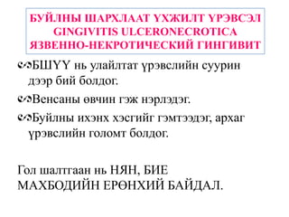 БУЙЛНЫ ШАРХЛААТ ҮХЖИЛТ ҮРЭВСЭЛ
    GINGIVITIS ULCERONECROTICA
 ЯЗВЕННО-НЕКРОТИЧЕСКИЙ ГИНГИВИТ
  БШҮҮ нь улайлтат үрэвслийн суурин
 дээр бий болдог.
  Венсаны өвчин гэж нэрлэдэг.
  Буйлны ихэнх хэсгийг гэмтээдэг, архаг
 үрэвслийн голомт болдог.

Гол шалтгаан нь НЯН, БИЕ
МАХБОДИЙН ЕРӨНХИЙ БАЙДАЛ.
 