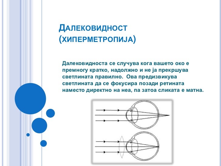 Закон око за око