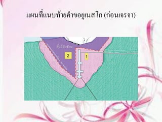 แผนที่แนบท้ายคาขอยูเนสโก (ก่อนเจรจา)
 