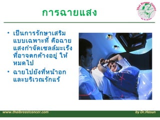 การฉายแสง
  • เป็น การรัก ษาเสริม
    แบบเฉพาะที่ คือ ฉาย
    แสงกำา จัด เซ้ลล์ม ะเร็ง
    ทีอ าจตกค้า งอยู่ ให้
      ่
    หมดไป
  • ฉายไปยัง ทีห น้า อก
                 ่
    และบริเ วณรัก แร้




www.thaibreastcancer.com        by Dr.Hasun
 