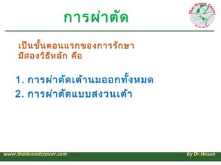 การผ่า ตัด
     เป็น ขั้น ตอนแรกของการรัก ษา
     มีส องวิธ ีห ลัก คือ

    1. การผ่า ตัด เต้า นมออกทั้ง หมด
    2. การผ่า ตัด แบบสงวนเต้า




www.thaibreastcancer.com               by Dr.Hasun
 