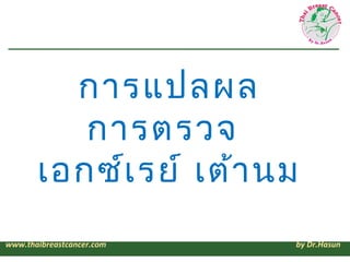 การแปลผล
          การตรวจ
       เอกซ์เ รย์ เต้า นม
www.thaibreastcancer.com   by Dr.Hasun
 
