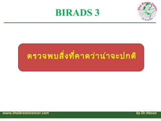 BIRADS 3



            ตรวจพบสิง ที่ค าดว่า น่า จะปกติ
                    ่




www.thaibreastcancer.com                ...