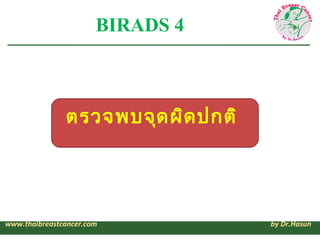 BIRADS 4



               ตรวจพบจุด ผิด ปกติ




www.thaibreastcancer.com            by Dr.Hasun
 