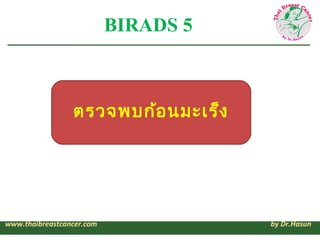 BIRADS 5



                 ตรวจพบก้อ นมะเร็ง




www.thaibreastcancer.com              by Dr.Hasun
 