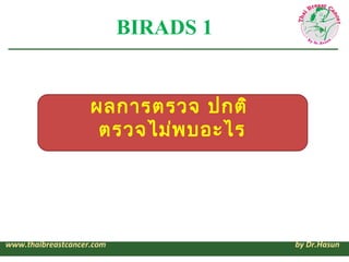 BIRADS 1


                    ผลการตรวจ ปกติ
                     ตรวจไม่พ บอะไร




www.thaibreastcancer.com            ...