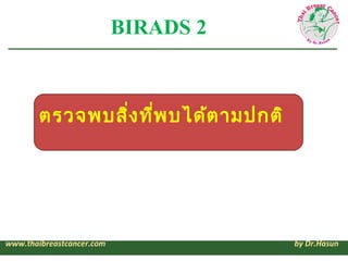 BIRADS 2



        ตรวจพบสิ่ง ทีพ บได้ต ามปกติ
                     ่




www.thaibreastcancer.com              by Dr.Has...