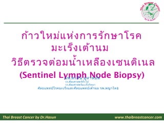 ก้า วใหม่แ ห่ง การรัก ษาโรค
              มะเร็ง เต้า นม
    วิธ ีต รวจต่อ มนำ้า เหลือ งเซนติเ นล
         (Sentinel Lymph...