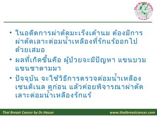 • ในอดีต การผ่า ตัด มะเร็ง เต้า นม ต้อ งมีก าร
      ผ่า ตัด เลาะต่อ มนำ้า เหลือ งที่ร ัก แร้อ อกไป
      ด้ว ยเสมอ
    • ...