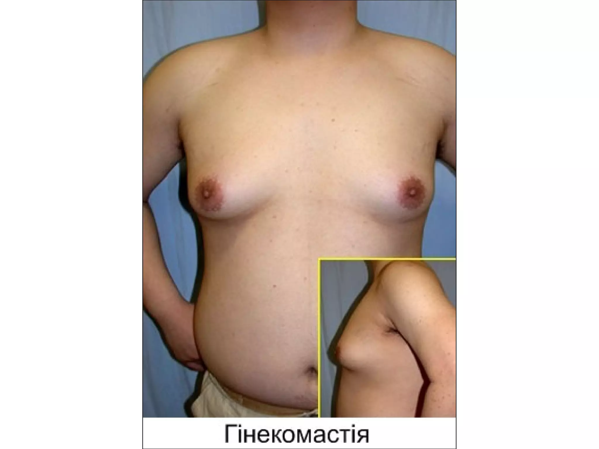 алкоголь страшний ворог