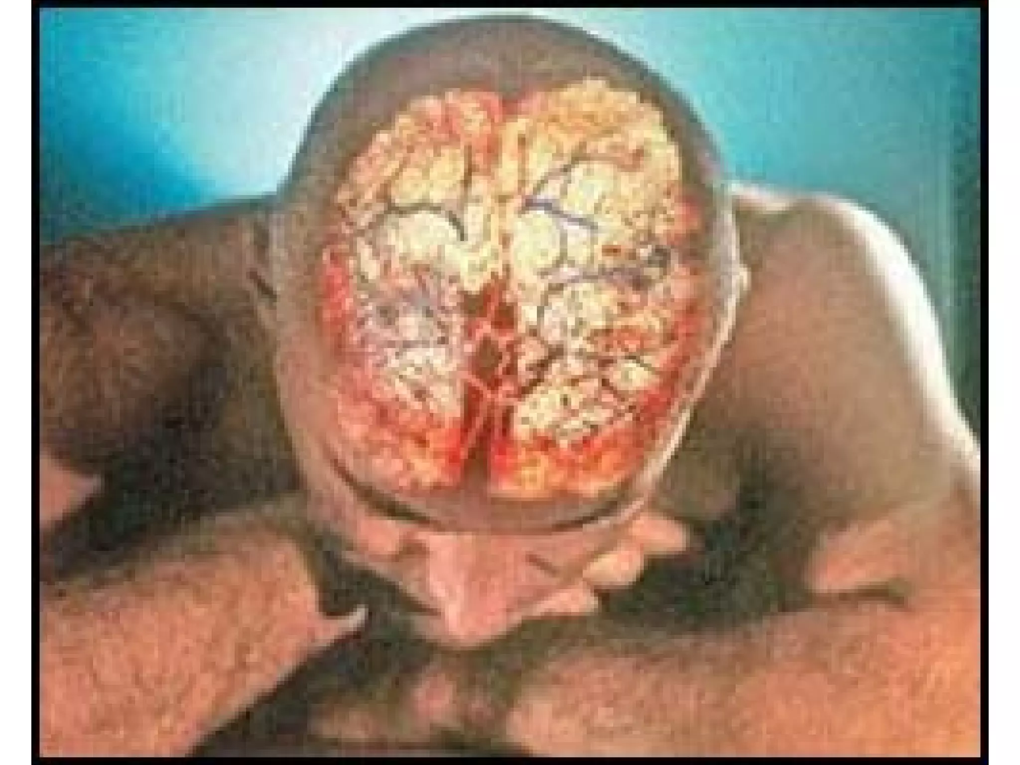 алкоголь страшний ворог