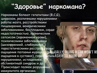 “Здоровье” наркомана?
Наркоманы болеют гепатитами (B,С,G),
циррозом, различными нарушениями
работы мозга, расстройствами
пищеварения, венерическими
заболеваниями, бесплодием, сердечной
недостаточностью, хроническим
сепсисом (заражением крови),
психическими заболеваниями
(шизофренией, слабоумием,
парастетическими расстройствами:
ощущения ползанья мурашек, грызущие
ощущения в суставах), гормональными
нарушениями, истощением,
абстинентный синдром и др.
Происходит полное разрушение
иммунитета организма.
 