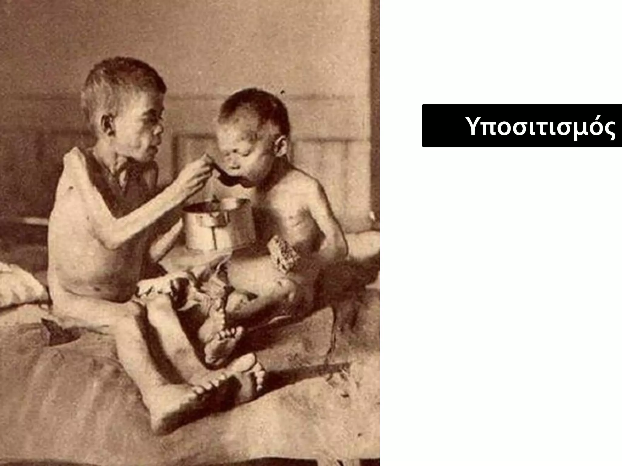 Υποσιτισμός
 