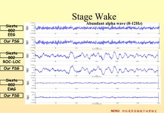 Stage Wake
             Abundant alpha wave (8-12Hz)
 Siesta
  802
  EEG
Our PSG


 Siesta
  802
ROC-LOC
Our PSG


 Siesta
  802
  EMG
Our PSG



                         NCKU \cXC挍
 