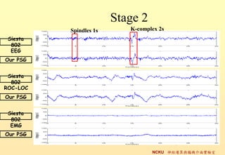 Stage 2
          Spindles 1s      K-complex 2s
 Siesta
  802
  EEG
Our PSG


 Siesta
  802
ROC-LOC
Our PSG


 Siesta
  802
  EMG
Our PSG
                                          20
                                  NCKU \cXC挍
 
