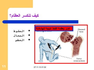 ‫ثكيف تنكسر العظام؟‬

                      ‫ثكسر بعظمة الفخذ نتيجة للهشاشة‬
       ‫السقوط‬   ‫‪‬‬

       ‫السعال‬   ‫‪‬‬

        ‫العطس‬   ‫‪‬‬




‫11‬                  ‫20:12 21.11.72‬
 