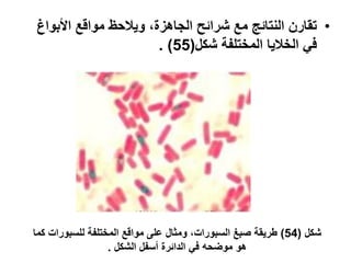‫• اختبار قدرة البكتيريا على الحركة‬
                                   ‫• ‪Motility Determination‬‬
‫تستخدم طريقة اختبار ...