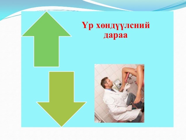 үр хөндөлт
