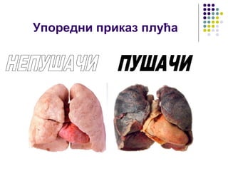 Упоредни приказ плућа
 