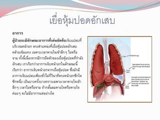เยื่อหุ้มปอดอักเสบ
อาการ
ผูป่วยจะมีลกษณะอาการที่เด่นชัดคือเจ็บแปลบที่
  ้            ั
บริเวณหน้าอก ตรงตาแหน่งทีเยือหุมปอดอักเสบ
                              ่ ่ ้
คล้ายเข็มแทง เฉพาะเวลาหายใจเข้าลึกๆ ไอหรือ
จาม ทังนี้เนื่องจากมีการยืดตัวของเยื่อหุมปอดทีกาลัง
       ้                                ้     ่
อักเสบ เราเรียกว่าอาการเจ็บหน้าอกในลักษณะนี้
เรียกว่า อาการเจ็บหน้าอกจากเยื่อหุมปอด ซึงมักมี
                                    ้      ่
อาการเจ็บแปลบเพียงชัวไม่กวนาทีตรงหน้าอกซีกใด
                        ่ ่ี ิ
ซีกหนึ่ง เป็ นบางครังบางคราวเฉพาะเวลาหายใจเข้า
                    ้
ลึกๆ เวลาไอหรือจาม ถ้ากลันลมหายใจหรือหายใจ
                            ้
ค่อยๆ จะไม่มอาการแต่อย่างใด
                 ี
 