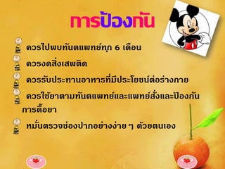 การปองกัน
              ้
 ควรไปพบทันตแพทย์ท ุก 6 เดือน
 ควรงดสิ่งเสพติด
 ควรรับประทานอาหารที่มีประโยชน์ต่อร่างกาย
 ควรใช้ยาตามทันตแพทย์และแพทย์สงและปองกัน
                                 ั่   ้
การดื้อยา
 หมันตรวจช่องปากอย่างง่ายๆ ด้วยตนเอง
    ่
 