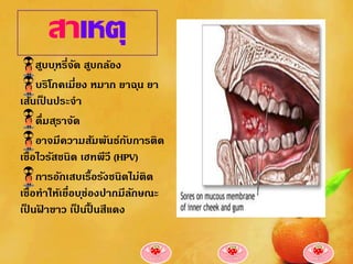 สาเหตุ
     สูบบ ุหรีจด สูบกล้อง
              ่ ั
     บริโภคเมี่ยง หมาก ยาฉ ุน ยา
เส้นเปนประจา
        ็
     ดื่มส ุราจัด
     อาจมีความสัมพันธ์กบการติด
                           ั
เชื้อไวรัสชนิด เฮทพีวี (HPV)
     การอักเสบเรื้อรังชนิดไม่ติด
เชื้อทาให้เยื่อบ ุช่องปากมีลกษณะ
                             ั
เปนฝาขาว เปนปนสีแดง
  ็ ้             ็ ้ื
 