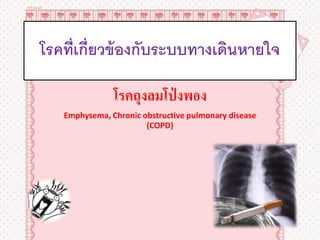 โรคที่เกี่ยวข้ องกับระบบทางเดินหายใจ

               โรคถุงลมโป่ งพอง
   Emphysema, Chronic obstructive pulmonary disease
                       (COPD)
 