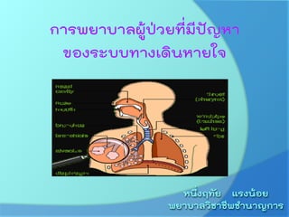 การพยาบาลผู้ป่วยที่มีปัญหา ของระบบทางเดินหายใจ