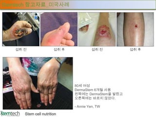 Stemtech 참고자료_미국사례




   섭취 전                섭취 후            섭취 전         섭취 후




                              80세 여성
                              DermaStem 6개월 사용
                              왼쪽에는 DermaStem을 발랐고
                              오른쪽에는 바르지 않았다.

                              - Annie Yen, TW

      Stem cell nutrition
 