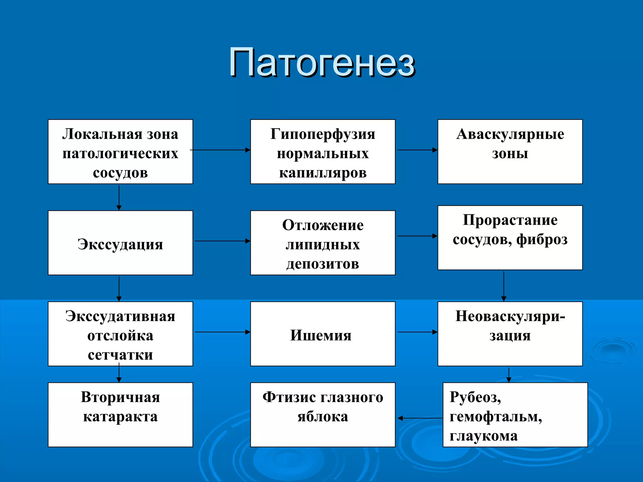 Патогенез
Локальная зона     Гипоперфузия     Аваскулярные
патологических      нормальных          зоны
    сосудов         капилляров


                    Отложение        Прорастание
 Экссудация         липидных        сосудов, фиброз
                    депозитов


Экссудативная                       Неоваскуляри-
  отслойка           Ишемия             зация
  сетчатки

  Вторичная       Фтизис глазного   Рубеоз,
  катаракта           яблока        гемофтальм,
                                    глаукома
 