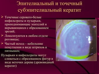Эпителиальный и точечный
          субэпителиальный кератит
 Точечные серовато-белые
  инфильтраты и пузырьки,
  приподнимающие эпителий и
  вкрывающиеся с образованием
  эрозий;
 Локализуются в любом отделе
  роговицы;
 Частый исход – небольшие
  помутнения в виде штрихов и
  пятнышек;
Пузырьки и инфильтраты могут
  сливаться с образованием фигур в
  виде веточки дерева (древовидный
  кератит)
 