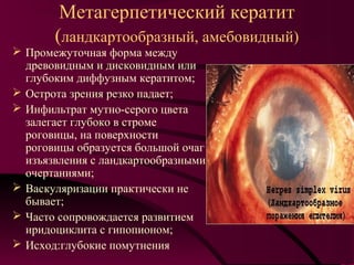Метагерпетический кератит
       (ландкартообразный, амебовидный)
 Промежуточная форма между
  древовидным и дисковидным или
  глубоким диффузным кератитом;
 Острота зрения резко падает;
 Инфильтрат мутно-серого цвета
  залегает глубоко в строме
  роговицы, на поверхности
  роговицы образуется большой очаг
  изъязвления с ландкартообразными
  очертаниями;
 Васкуляризации практически не
  бывает;
 Часто сопровождается развитием
  иридоциклита с гипопионом;
 Исход:глубокие помутнения
 