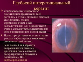 Глубокий интерстициальный
                       кератит
 Сопровождается диффузным
  помутнением практически всей
  роговицы с отеком эпителия, местами
  его эрозиями, отеком
  стромы,наличием в ней
  воспалительных или некротических
  очагов, складчатостью десцеметовой
  оболочки(временном снятии отека)
 Исход: при устранении отека стромы
  участки инфильтрации заменяются
  соединительной тканью
  Если данный вид кератита
  сопровождается тяжелым
  иридоциклитом с очаговой
  васкуляризацией радужки, с
  повышением ВГД -
  кератоиридоциклит
 