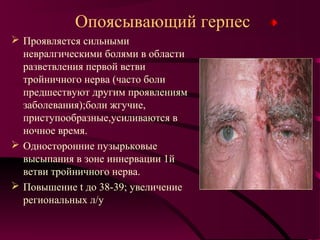 Опоясывающий герпес
 Проявляется сильными
  невралгическими болями в области
  разветвления первой ветви
  тройничного нерва (часто боли
  предшествуют другим проявлениям
  заболевания);боли жгучие,
  приступообразные,усиливаются в
  ночное время.
 Односторонние пузырьковые
  высыпания в зоне иннервации 1й
  ветви тройничного нерва.
 Повышение t до 38-39; увеличение
  региональных л/у
 