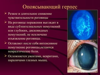Опоясывающий герпес
 Резкое и длительное снижение
  чувствительности роговицы
 На роговице поражения выглядят в
  виде субэпителиальных помутнений
  или глубоких, дисковидных
  помутнений; не исключено
  изъязвление роговицы.
 Оставляет после себя интенсивное
  помутнение роговицы,остаются
  невралгические боли.
 Осложняется увеитами, невритами,
  параличами глазных мышц.
 