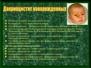Возникает в первые дни или недели жизни
   Встречается у 1-2% всех новорожденных
   Основная причина – атрезия выходного отверстия носослезного канала
   До 8 месяца внутриутробного развития выходное отверстие закрыто тонкой
   перепонкой,а его полость до рождения заполнена желатинообразной массой
   из слизи и эпителия
   К моменту рождения у большей части детей перепонка подвергается
   обратному развитию
   Слизистая пробка проходит нос при первых дыхательных движениях и
   крике новорожденного
Другие причины дакриоциститов:
   сужение при переходе слезного мешка в слезно-носовой канал
   складки, дивертикулы слизистой
   искривления по ходу костного и мягкотканного канала
   искривление носовой перегородки с перекрытием выходного отверстия
   протока сравнительно толстой нижней раковиной
 
