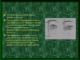 Техника зондирования слезно-
носового канала.
После эпибульбарной анестезии и
введения в полость слезного мешка
р-а дикаина проводят зонд Боумена
№1 по предварительно
расширенному слезному канальцу
до кости.
Придерживаясь костной стенки ,
скользя по ней, переводят зонд в
вертикальное положение, а затем
осторожно продвигают вниз и
кнаружи в слезно-носовой проток.
 