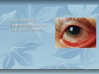 Демодекозный
блефароконъюнктив
ит, стертое течение
 