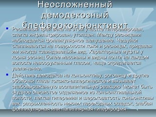Неосложненный
              демодекозный
      блефароконъюнктивит
    Ресничный край века на этом участке гиперемирован,
    слегка инфильтрирован, утолщен. Между ресницами
    наблюдается фолликулярное шелушение. Чешуйки
    скапливаются на поверхности кожи и ресницах, придавая
    им иногда «заиндевелый» вид. Характерные муфты у
    корня ресниц более массивны и видны почти на каждом
    волоске невооруженным глазом, чаще определяется
    увеличение.
   Действие демодекса на конъюнктиву, роговицу и другие
    оболочки глаза токсико-аллергическое и вызывает
    слабовыраженную воспалительную реакцию (может быть
    скудное слизистое отделяемое из конъюнктивальной
    полости, легкая гиперемия и шероховатость конъюнктивы
    век, разрыхленность нижних переходных складок, слабая
    фолликулярная или папиллярная гипертрофия
 