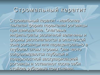 Стромальный кератит
Стромальный кератит - наиболее
тяжелая форма поражения роговицы
при демодекозе. Очаговые
инфильтраты различной величины и
формы располагаются в оптической
зоне роговицы или парацентрально в
глубоких слоях стромы. Они часто
сопровождаются глубокой и
поверхностной васкуляризацией
роговицы и оставляют после себя
стойкие рубцовые помутнения.
 
