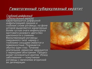 Гематогенный туберкулезный кератит
Глубокий диффузный
туберкулезный кератит
характеризуется диффузной
инфильтрацией средних и
глубоких слоев роговицы, на фоне
которой выделяются характерные
более густые очаги инфильтрата
желтовато-розового цвета без
наклонности к слиянию.
Васкуляризация роговицы
смешанного типа: наряду с
глубокими сосудами имеются и
поверхностные. Поражается
обычно один глаз. Течение
длительное, ремиссии чередуются
с периодами обострения. Процесс
может осложняться иритом. Исход
заболевания — помутнения
роговицы с явлениями вторичной
ее дегенерации.
 